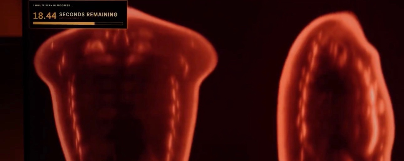 El escáner de Midjourney: De la generación de imágenes por IA a la revolucionaria imagenología ultrasónica de cuerpo completo