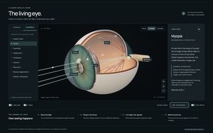 3D Human Eye Model for Myopia Study