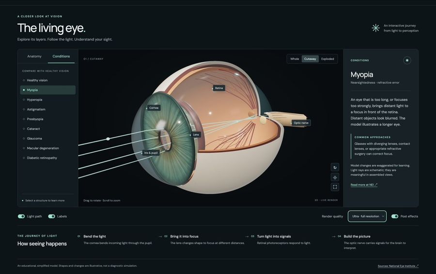 3D Human Eye Model for Myopia Study